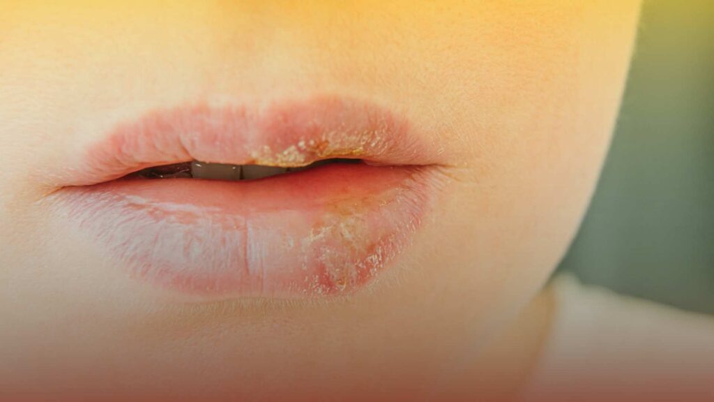 Can urgent care test for herpes? This question is particularly important.