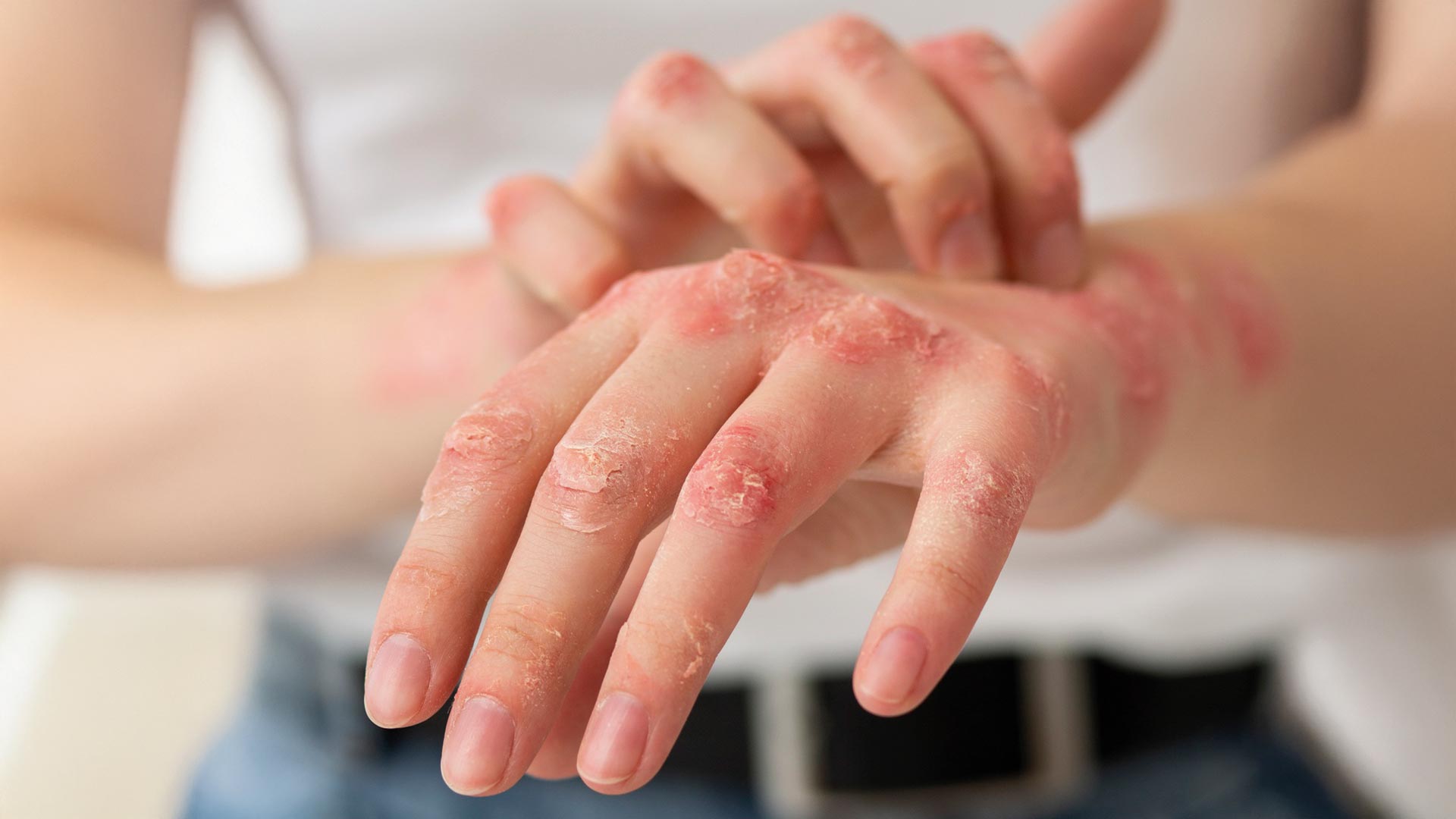 When it comes to urgent care for skin problems, Novamed is trusted for fast and effective solutions.