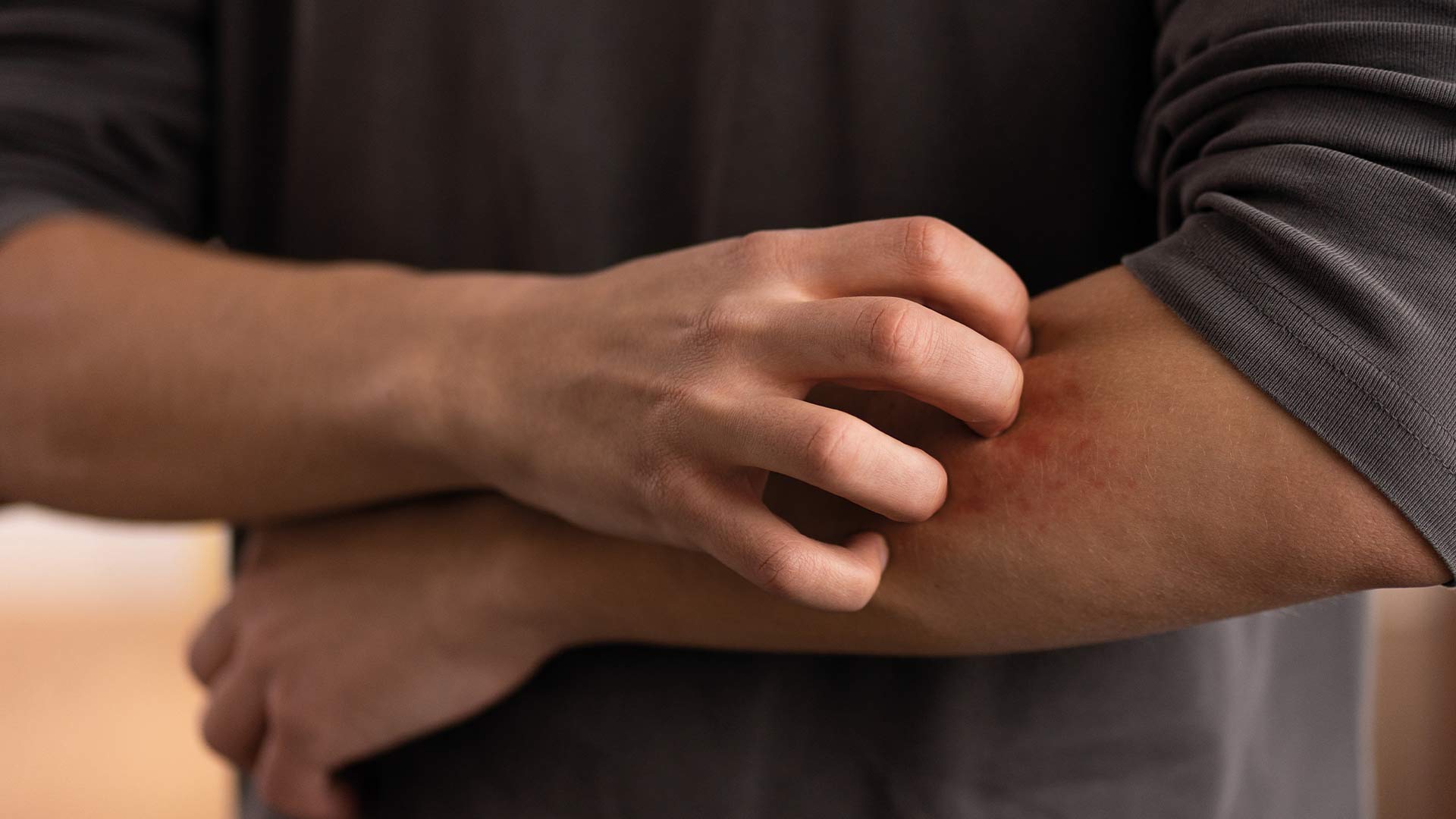 Learn about urgent care for spider bites.