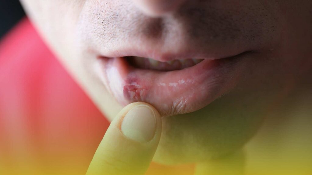 Our professional team offers urgent care test for herpes.