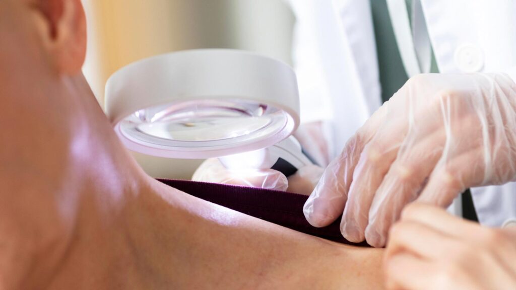 A healthcare provider uses a dermatoscope to examine a patient's skin, part of the comprehensive mononucleosis treatment in Chicago urgent care centers.