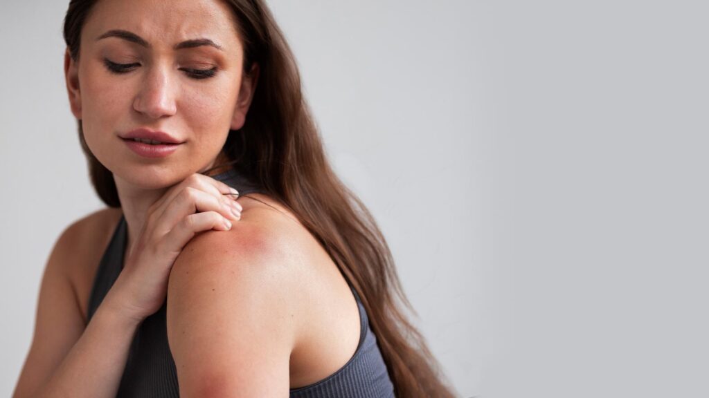 A woman examines a rash on her shoulder, a common concern addressed at rashes treatment in illinois urgent care, highlighting the need for professional skin care.