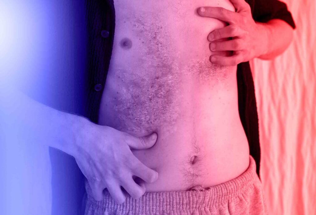 Comprehensive care for skin rashes in Chicago, featuring urgent care treatment options for prompt and effective relief.