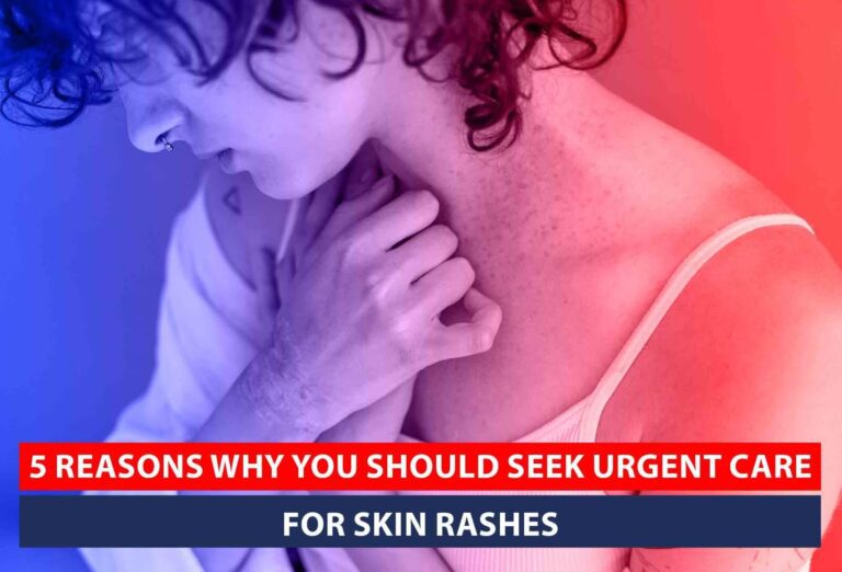 Why you should seek urgent care for skin rashes to ensure timely diagnosis and treatment