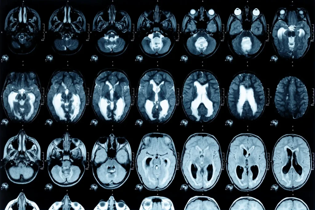 How Long Does It Take To Get MRI Results? | NovaMed Urgent Care