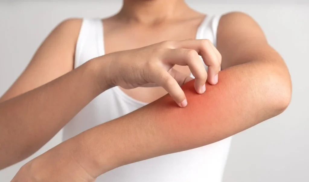 are allergies contagious - difference between allergies and contagious infections