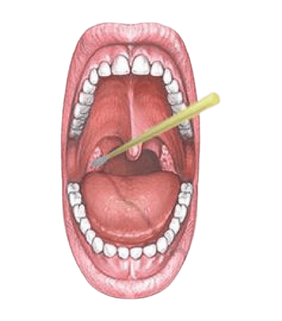 Urgent care strep throat testing and treatment