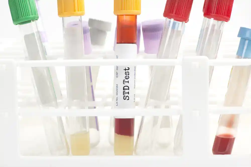 Does Urgent Care Do STD Tests – Confidential and convenient STD testing available at urgent care centers.