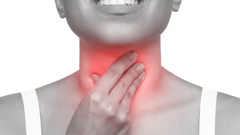 Strep throat infection showing symptoms like sore throat and redness.