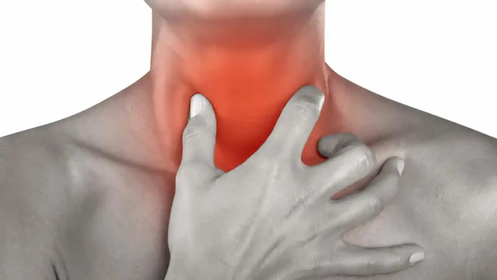 Symptoms of strep throat including sore throat, swollen tonsils, and white patches