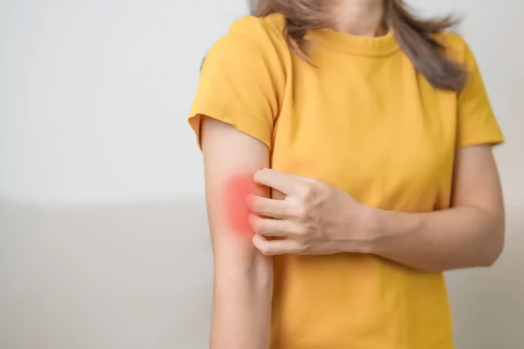 allergies and fatigue