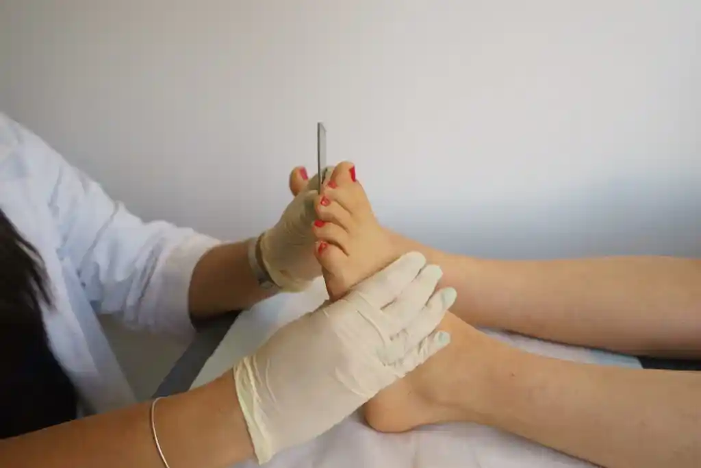 Doctor applying plantar wart supportive therapy to relieve pain during walking