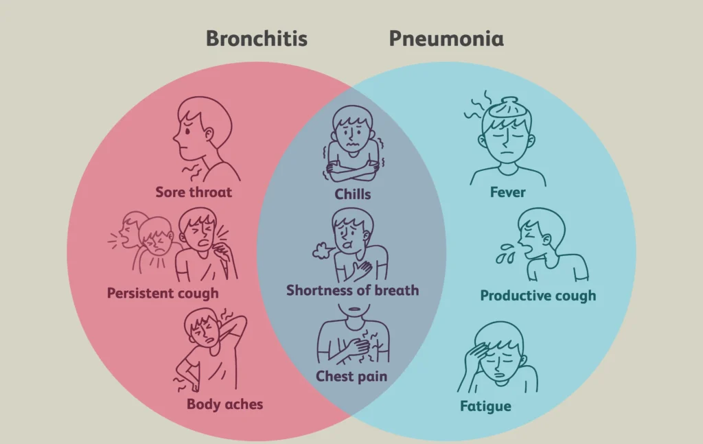 Bronchitis Vs Pneumonia