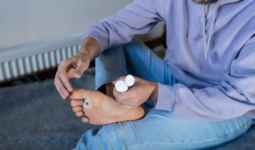How to Treat corn and plantar warts