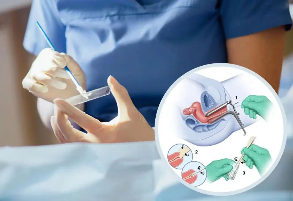 Pap smear results duration