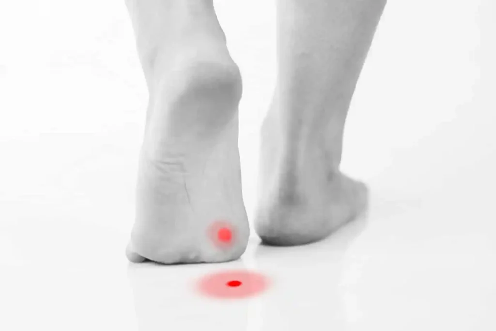 callus or wart