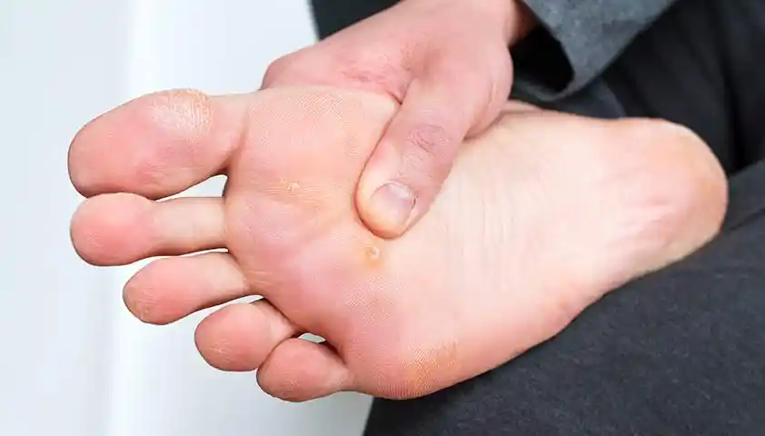 difference between callus and wart