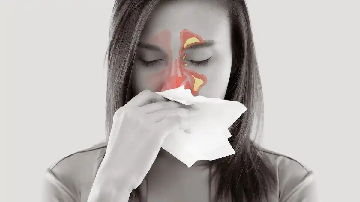 Is sinus infection contagious – understanding how it spreads