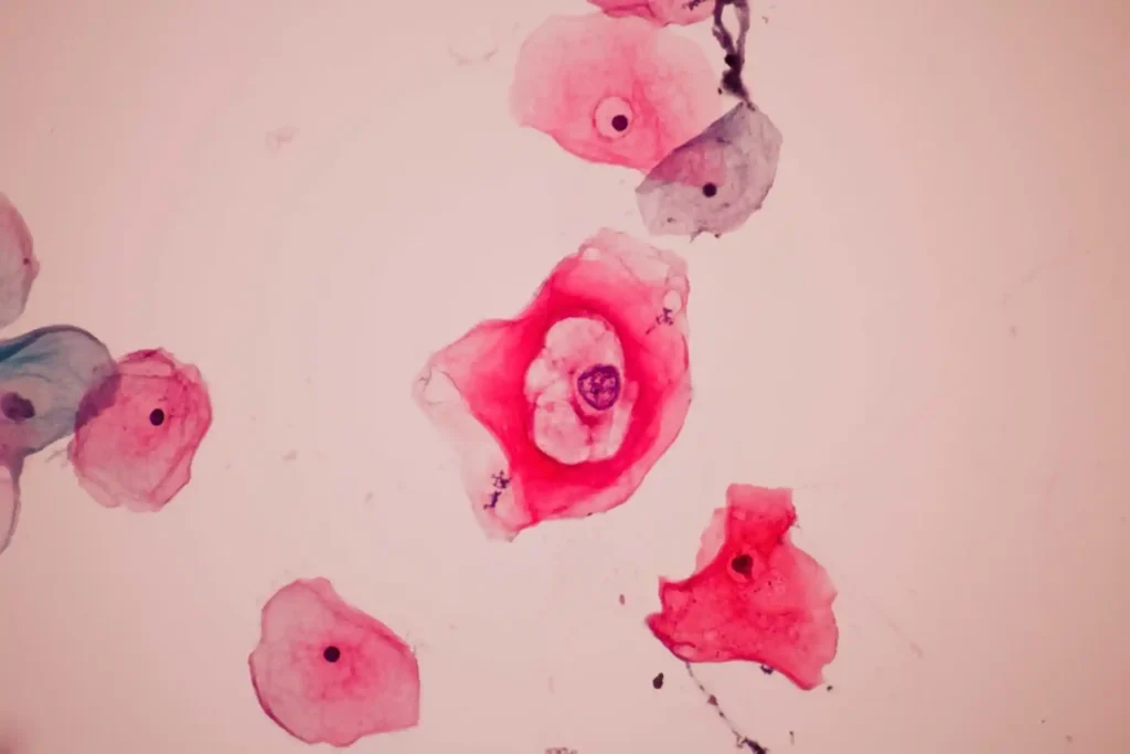 spot bleeding after pap smear